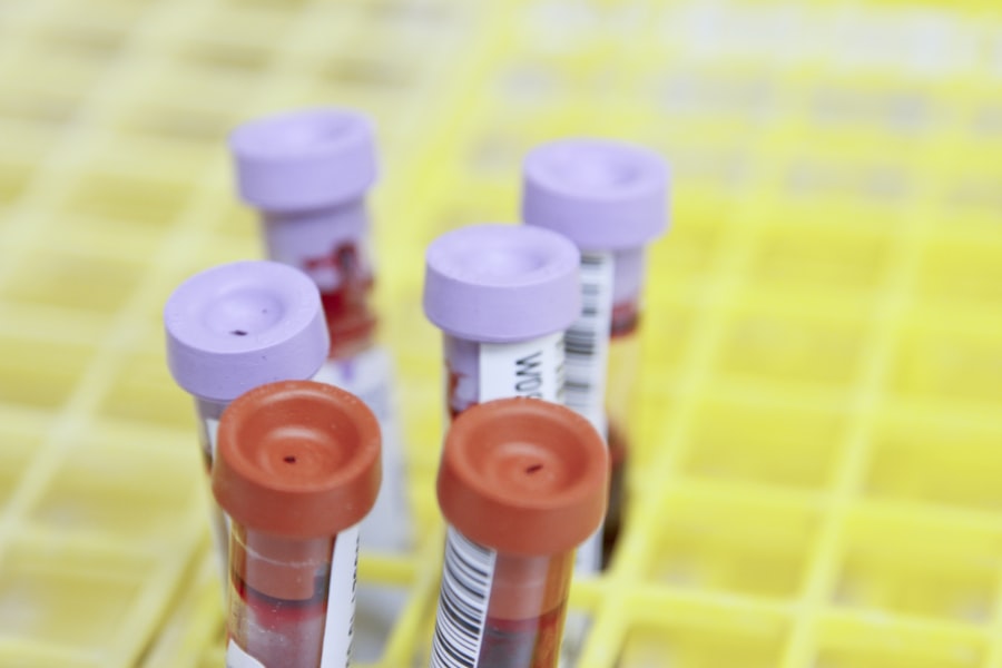 Hygienic & professional phlebotomists